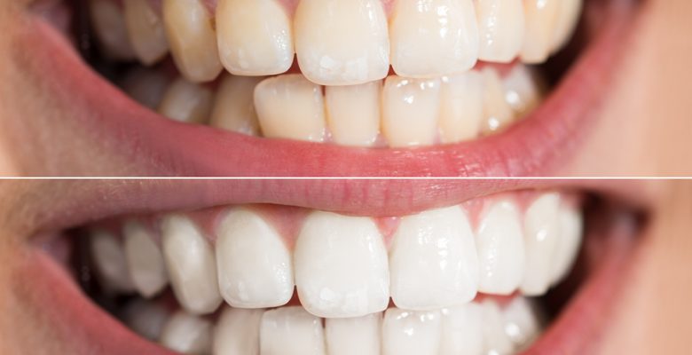 Why seeing a dentist in Windsor NSW could be the difference