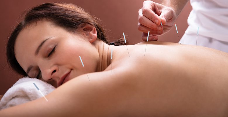 8 Reasons to Try Dry Needling for Pain Relief