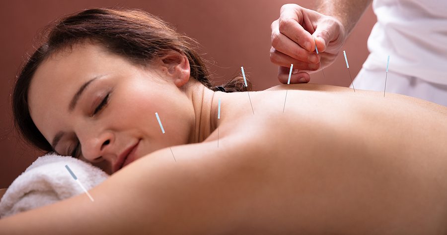 8 Reasons to Try Dry Needling for Pain Relief